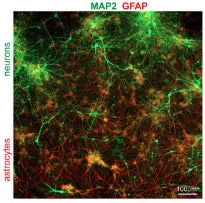 Anti-Microtubule Associated Protein 2 (MAP2) Antibody - Image 5