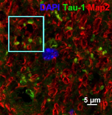 Anti-Microtubule Associated Protein 2 (MAP2) Antibody - Image 6