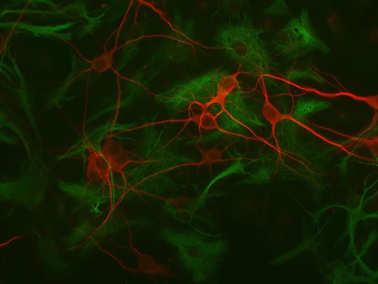 Anti-Microtubule Associated Protein 2 (MAP2) Antibody - Image 7