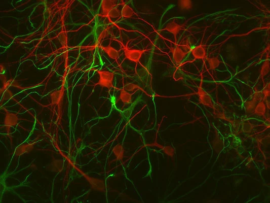 Anti-Microtubule Associated Protein 2 (MAP2) Antibody - Image 8