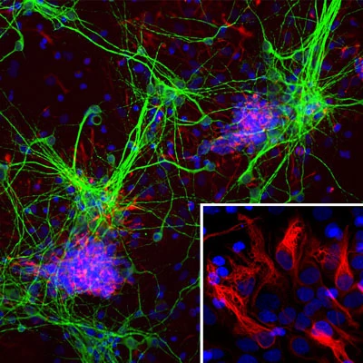 Anti-Microtubule Associated Protein 2 (MAP2) Antibody - Image 9