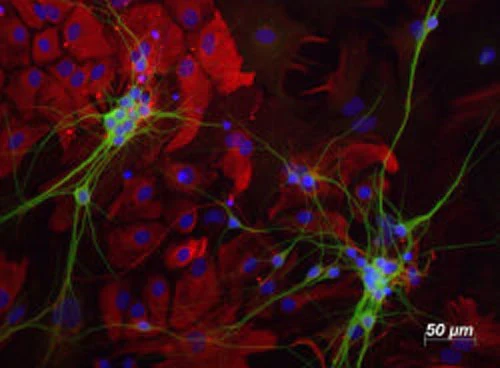 Anti-Microtubule-Associated Protein (MAP2) Antibody - Image 2