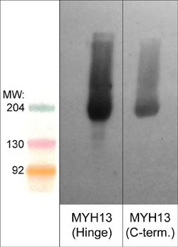 Anti-Myosin 13/Extraocular Myosin (Hinge region) Antibody