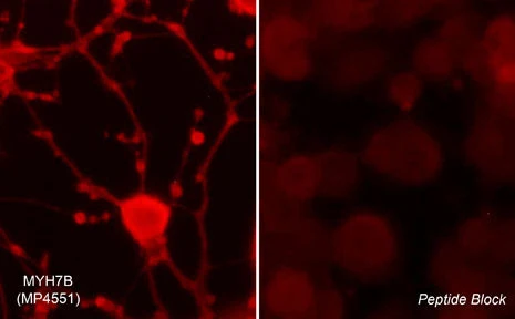 Anti-Myosin 7B/MHC14 (Hinge region) Antibody - Image 2