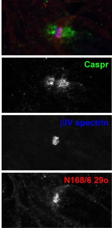 Anti-Navbeta4 Na+ Channel Antibody