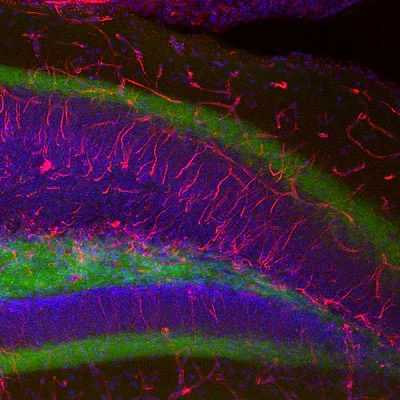 Anti-Nestin Antibody
