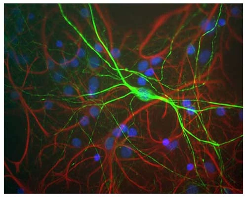 Anti-Neurofilament Heavy, phosphorylated and non-phosphorylated (pNF-H) Antibody