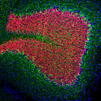 Anti-Neurofilament NF-L Antibody - Image 2