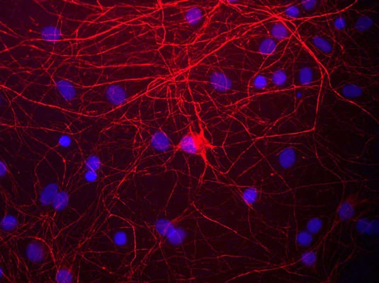 Anti-Neurofilament NF-M Antibody - Image 3