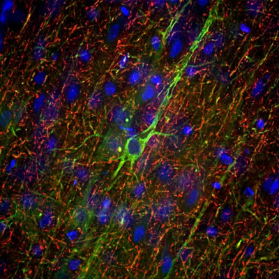 Anti-Neurofilament NF-M Antibody - Image 2