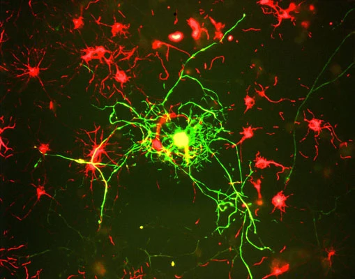 Anti-Neurofilament NF-M Antibody - Image 3