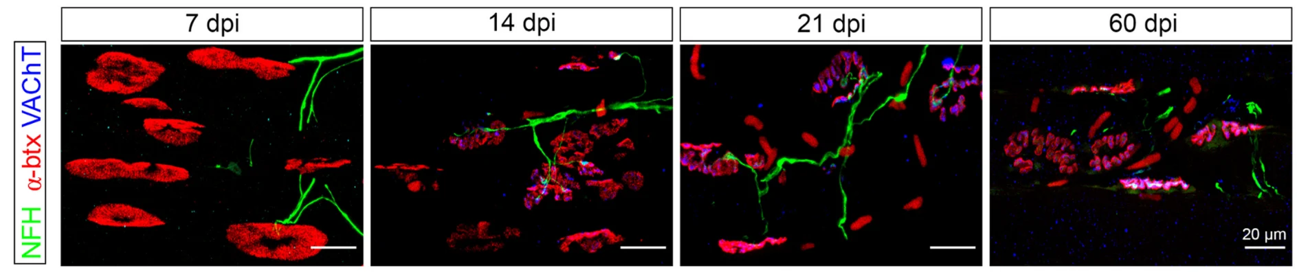 Anti-NFH (Neurofilament Heavy Chain) Antibody - Image 4