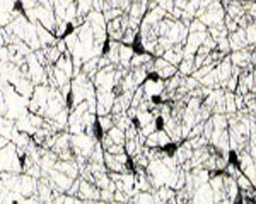 Anti-NGFR/p75 Neurotrophin Receptor (p75NTR) Antibody - Image 2