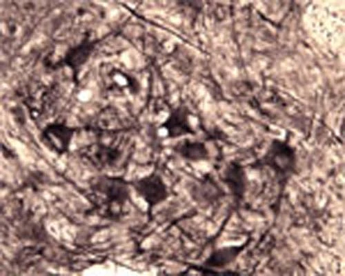 Anti-NGFR/p75 neurotrophin receptor (p75NTR) Antibody