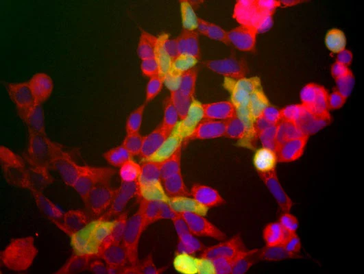 Anti-NSE (Neuron specific enolase) Antibody - Image 2
