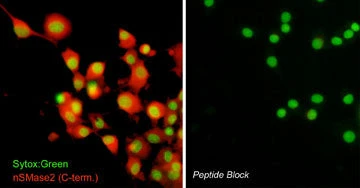 Anti-nSMase2 (C-terminal region) Antibody - Image 2