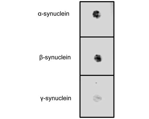 Anti-Pan-synuclein Antibody