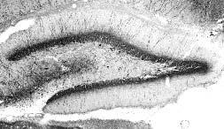 Anti-Parvalbumin Antibody