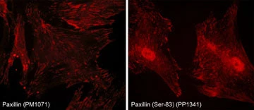 Anti-Paxillin Antibody - Image 2