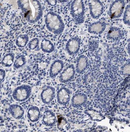 Anti-Peptide YY Antibody - Image 2