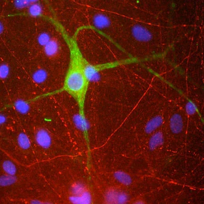 Anti-Peripherin Antibody - Image 2