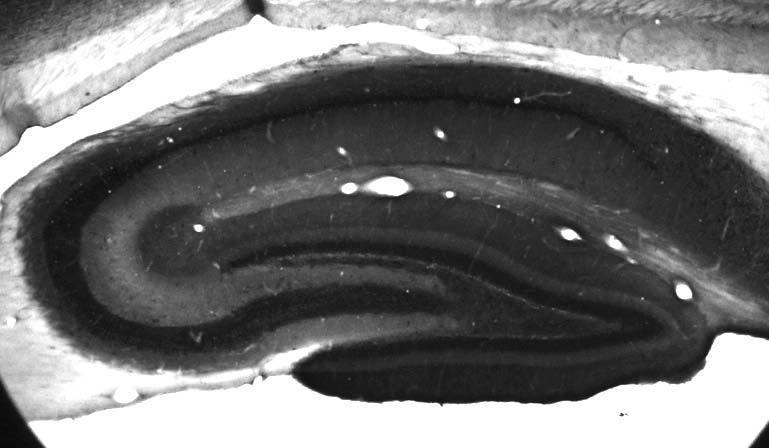 Anti-PICK1 Antibody - Image 2