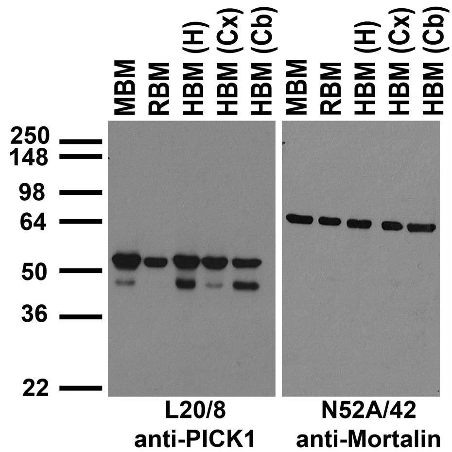Anti-PICK1 Antibody - Image 3