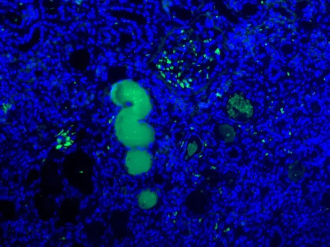 Anti-Pro/Actived Complement C1s Antibody