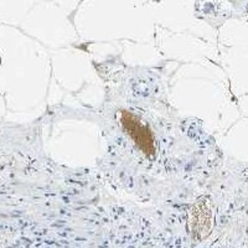 Anti-Pro/Actived Complement C1s Antibody