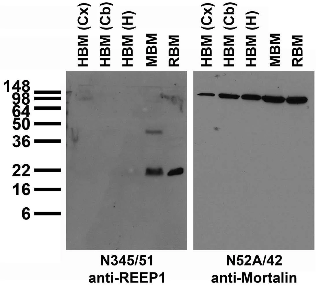 Anti-REEP1 Antibody - Image 3