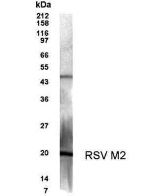 Anti-RSV M2 Protein Antibody
