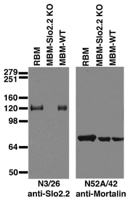 Anti-Slo2.2/Slack K+ Channel Antibody