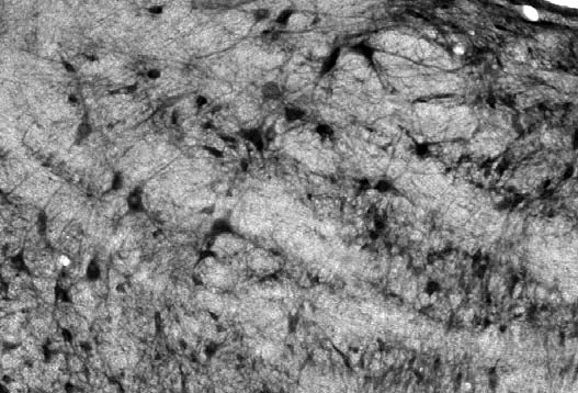 Anti-Slo2.2/Slack K+ Channel Antibody - Image 5