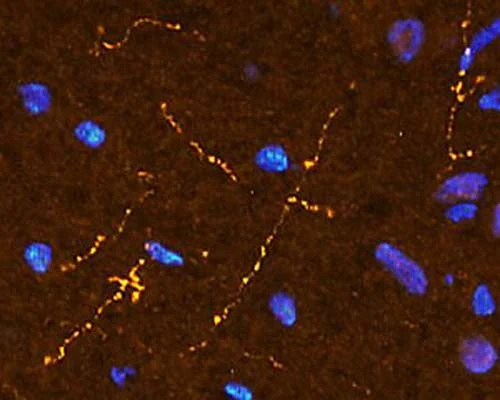 Anti-Somatostatin Antibody