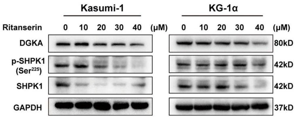Anti-Sphingosine Kinase 1 (Ser-225), Phosphospecific Antibody - Image 3