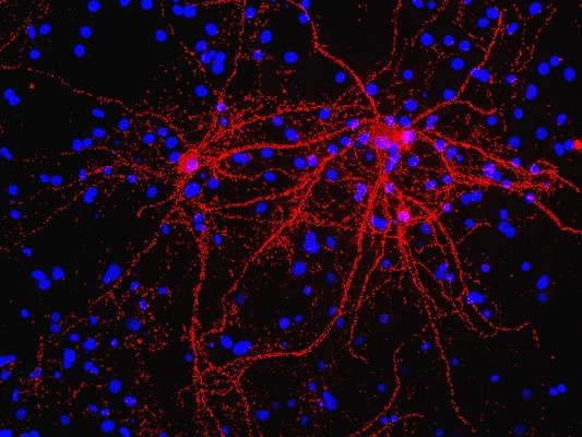 Anti-Synapsin I (100 µL) Antibody - Image 2