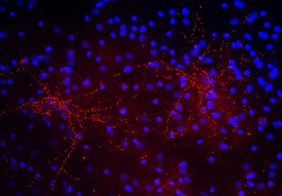 Anti-Synaptophysin 2 Antibody - Image 2