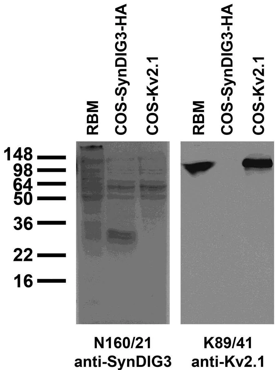 Anti-SynDIG3/Tmem91 Antibody - Image 2