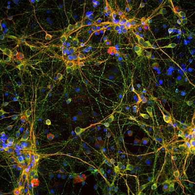 Anti-Tau Antibody - Image 2