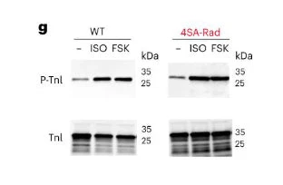 Anti-Troponin I (cardiac) Ser23/24 Antibody - Image 2