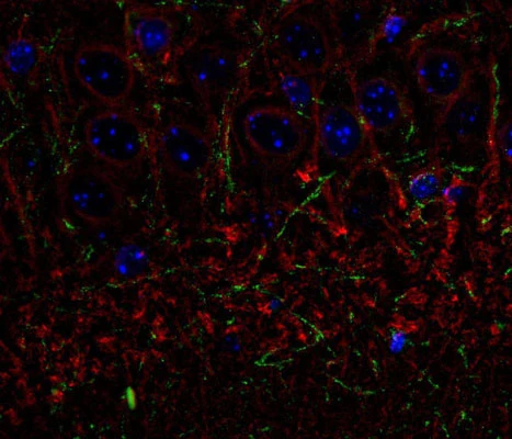 Anti-Tubulin, beta III Antibody - Image 3