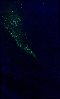 Anti-Tyrosine Hydroxylase (TYH) Antibody - Image 12