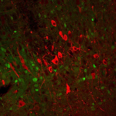 Anti-Tyrosine Hydroxylase (TYH) Antibody - Image 4