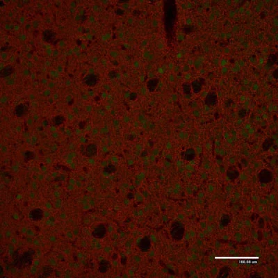 Anti-Tyrosine Hydroxylase (TYH) Antibody - Image 8