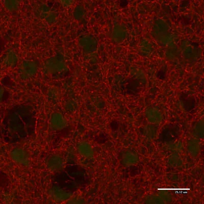 Anti-Tyrosine Hydroxylase (TYH) Antibody - Image 9
