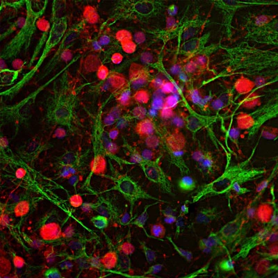Anti-Ubiquitin C-terminal Hydrolase 1 (UCHL1) Antibody - Image 2