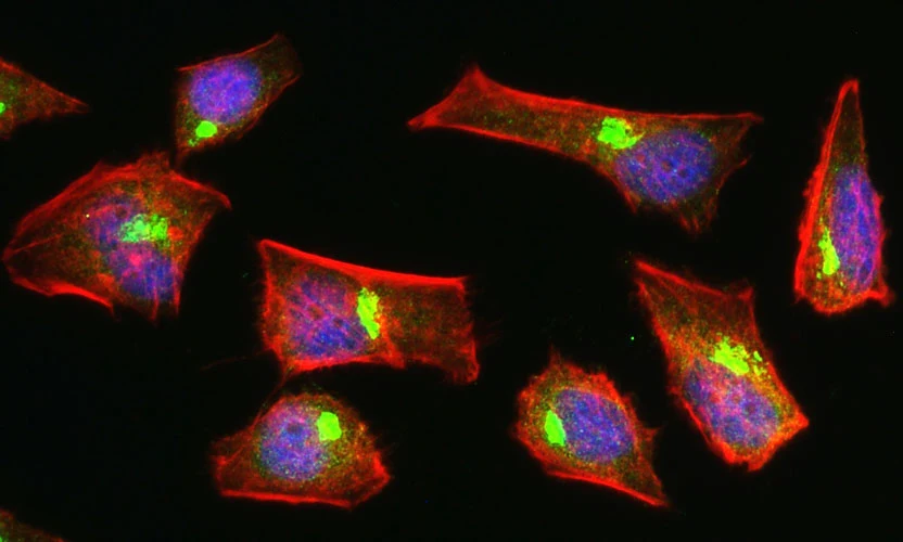 Anti-UFSP2 Antibody - Image 3