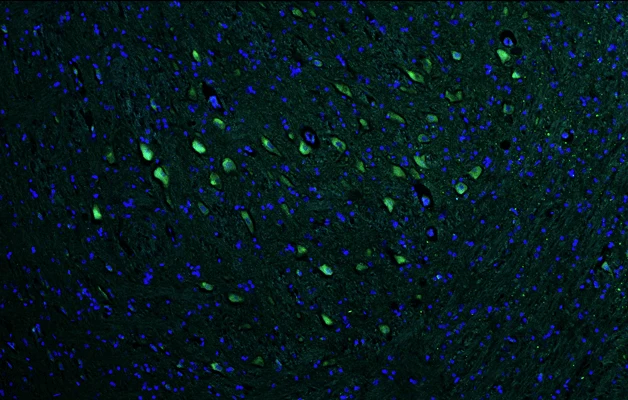 Anti-VAChT Recombinant Chicken Chimeric mAb