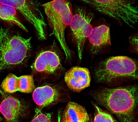 Anti-Vimentin Antibody - Image 7