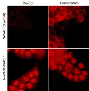 Anti-WASP / N-WASP Antibody - Image 2